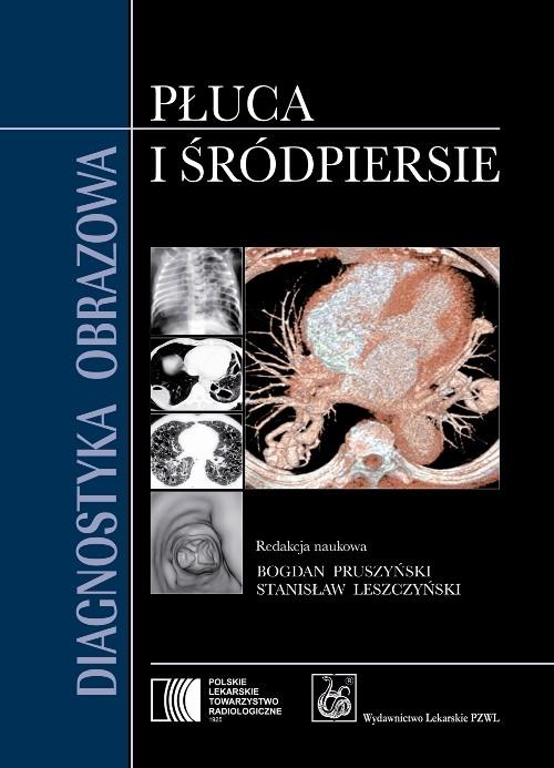 

Diagnostyka obrazowa Płuca Pruszyński Leszczyński