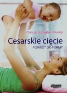 Cesarskie cięcie Powrót do formy Chrissie Gallagher-Mundy