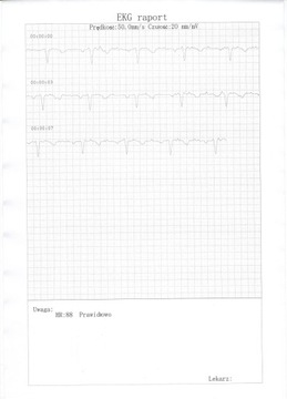 Monitor EKG, puls, tętno, zaburzenia rytmu serca + przewodnik EKG