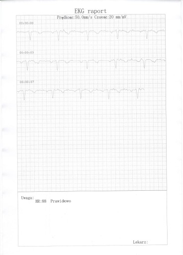 Monitor EKG, puls, tętno, zaburzenia rytmu serca + przewodnik EKG